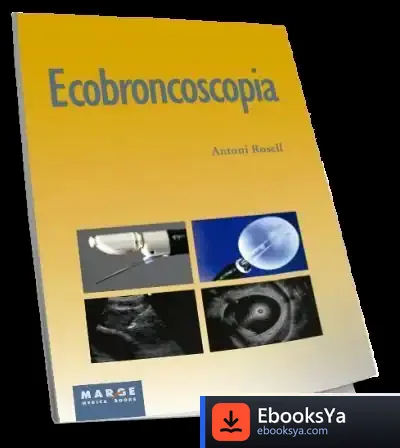 Descargar Ecobroncoscopia de Sara de la Rica Goiricelaya