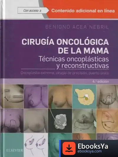 Descargar Cirugía Oncológica De La Mama.4ª Ed
