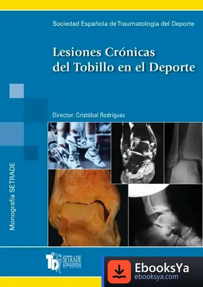 Descargar Lesiones Crónicas Del Tobillo En El Deporte de Cristóbal Rodríguez Hernández