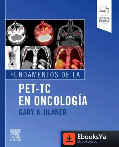 Descargar Fundamentos De La Pet-Tc En Oncología