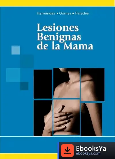 Descargar Lesiones Benignas De La Mama de Alfonso-vicente Carrascosa Santiago