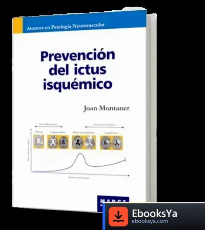 Descargar Prevención Del Ictus Isquémico de Alexey Pehov