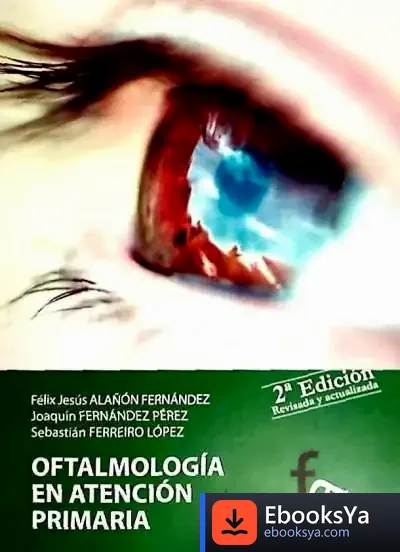 Descargar Oftalmología En Atención Primaria de Antonio Rosa Palomero