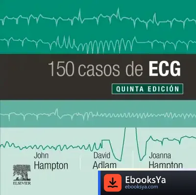 Descargar 150 Casos De Ecg