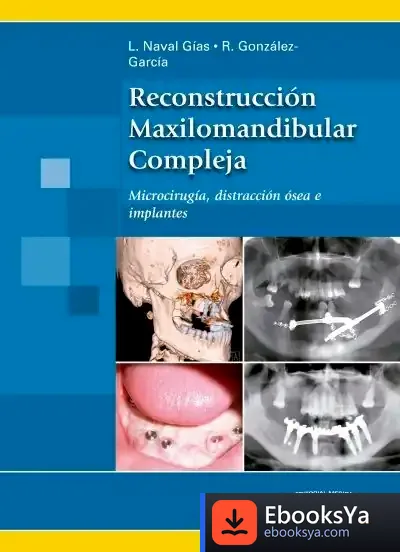 Descargar Reconstrucción Maxilomandibular Compleja