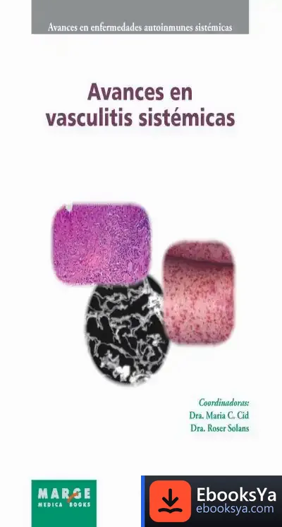Descargar Avances Vasculitis Sistémicas