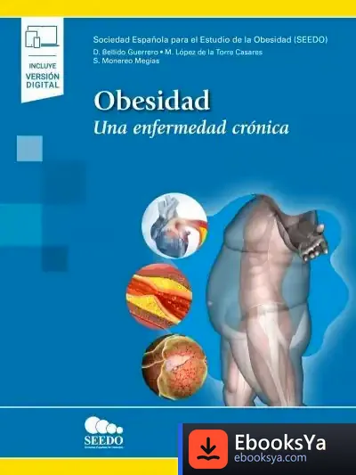 Descargar Obesidad (+ E-Book): Una Enfermedad Crónica